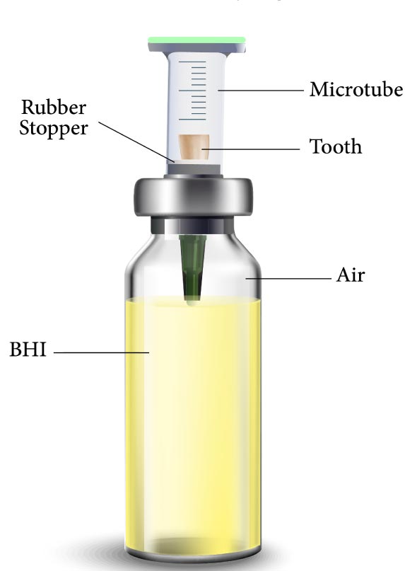 Efficacy of MTA Modified by Nanosilver for the Prevention of Coronal Leakage