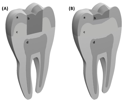 Temperature Rise at the Pulp-Dentin Junction for a Multi-Layered Composite Restoration using the Finite Element Method