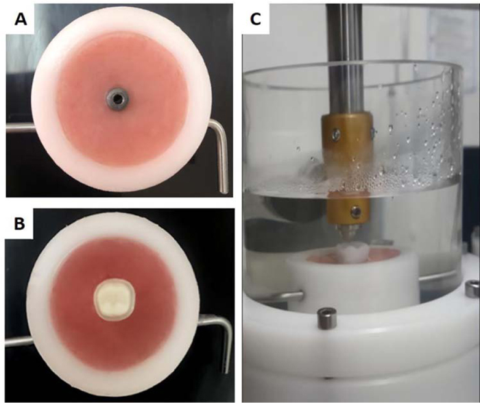  Fatigue and Fracture Load of Monolithic Ceramic Crowns Supported by Hybrid Abutment