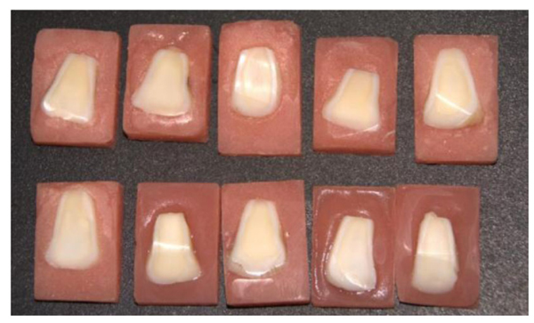 Evaluation of the Effect of Cold Plasma Treatment on the Microshear Bond Strength of Composite Resin Restorations to Dentin using Different Adhesive Systems and the Effect of Thermocycling