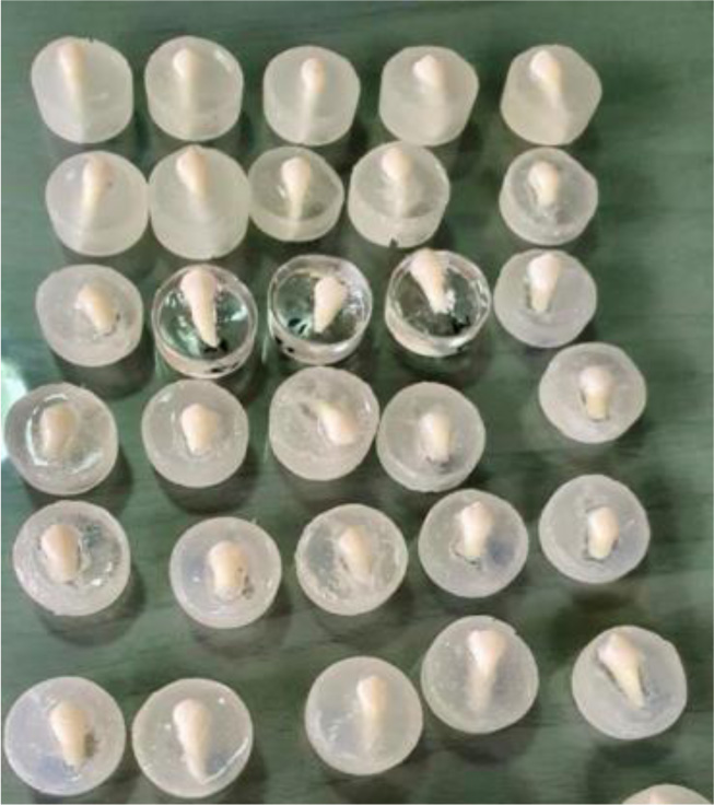 Differences of Enamel Microhardness Post External Bleaching After Application with Casein Phosphopeptide Amorphous Phosphate (CPP-ACP) and 5% Sodium Fluoride (NAF)