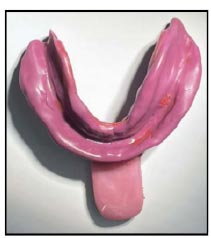 Conventional Border Molding Digital Impression on Complete Denture Impression: A Review