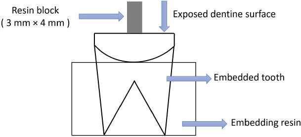Effect of Chlorhexidine and Ozone Gel on Microleakage and Shear Bond Strength of Dentin Bonding Agents in Composite Resin Restorations of Primary Teeth