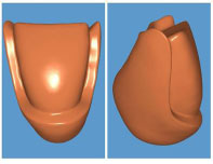 The Effect of Preparation Design on Stress Distribution in Lithium Disilicate Laminate Veneer using 3D Finite Element Analysis.
