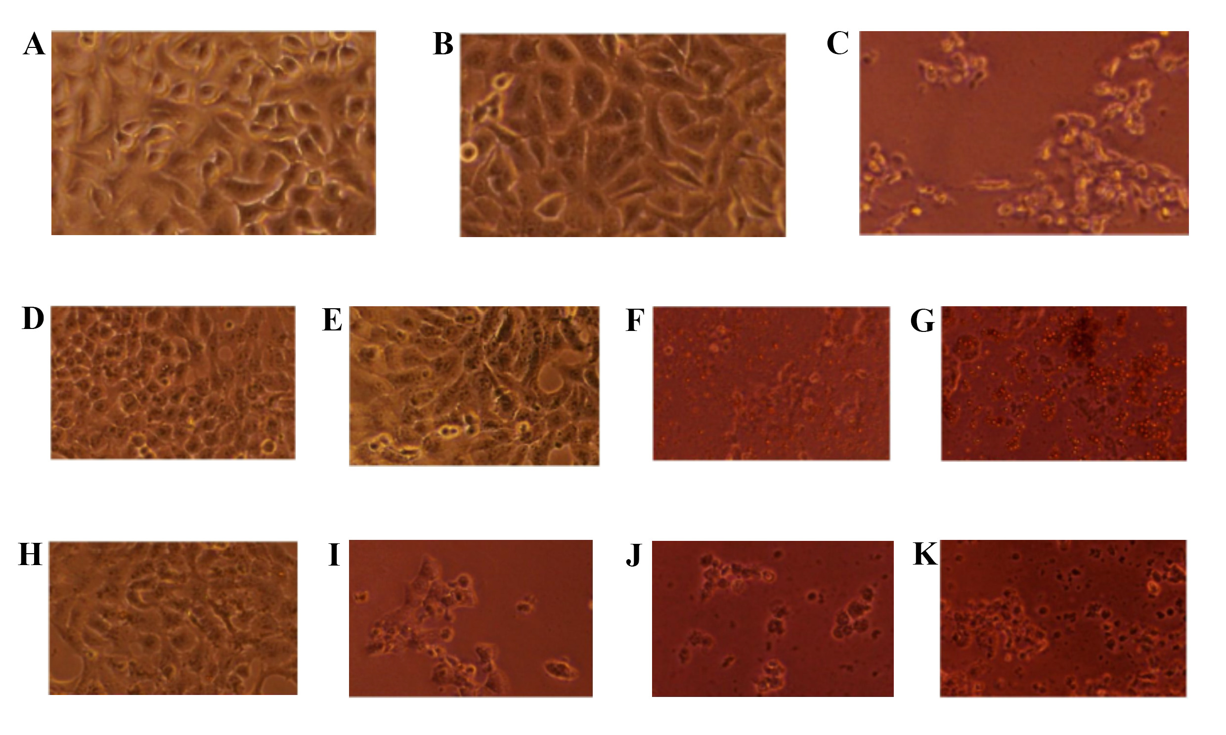 Cytotoxic Effects of Ethyl Acetate and Hexane Extracts of L. on Cal 27 Oral Cancer Cells