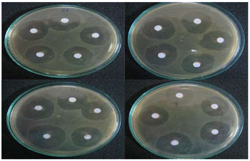 An  Evaluation of the Antibacterial and Remineralizing Efficacy of a Silver Nanoparticle-Containing Toothpaste